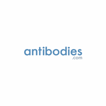 Segnaposto immagine Antibodies.com - Scopri di più spendendo meno